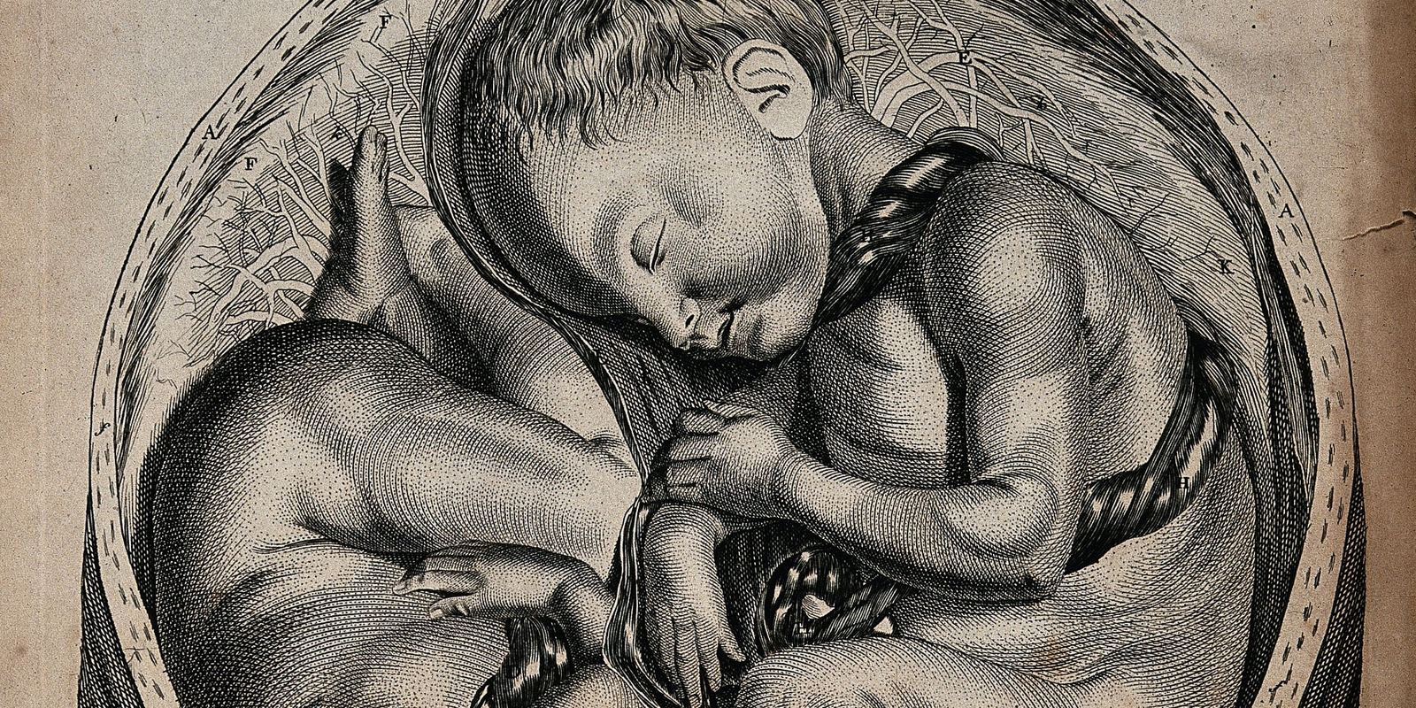 A historical engraving showing a cross-section of a womb containing twins
